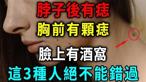 脖子後面有痣男|男人脖子后面有痣的十三种痣相解析！